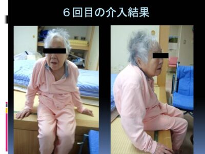 関節拘縮・・・身体が硬くなり自分では動かせない状態をいいます・・・今日はこれを改善する勉強会です